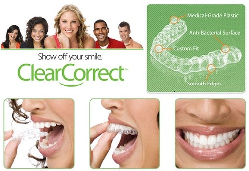 Use ClearCorrect To Straighten Teeth Without Metal Braces