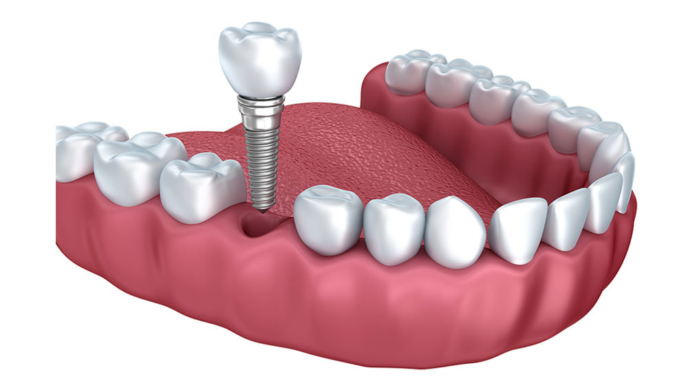 Advanced Dental Concepts