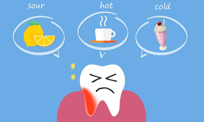 Tooth Sensitivity After Filling: Symptoms, Causes, and Treatment