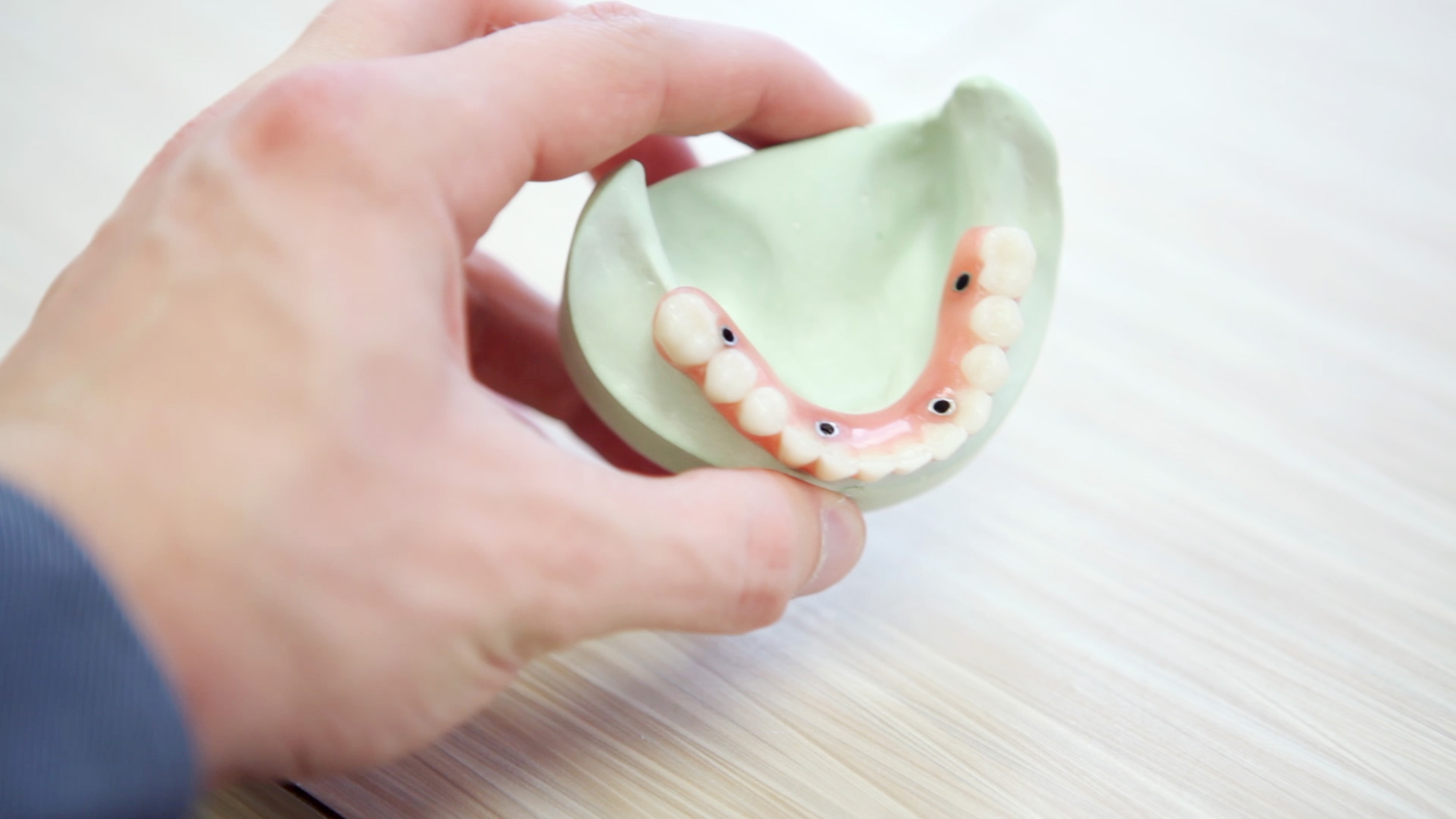 Temporary Dental Implant for Children with Missing Teeth