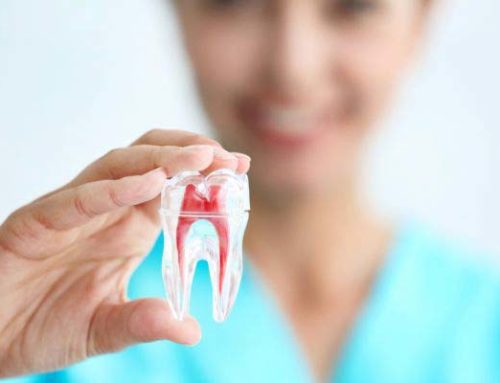 Things To Know Before Considering Root Canal Therapy