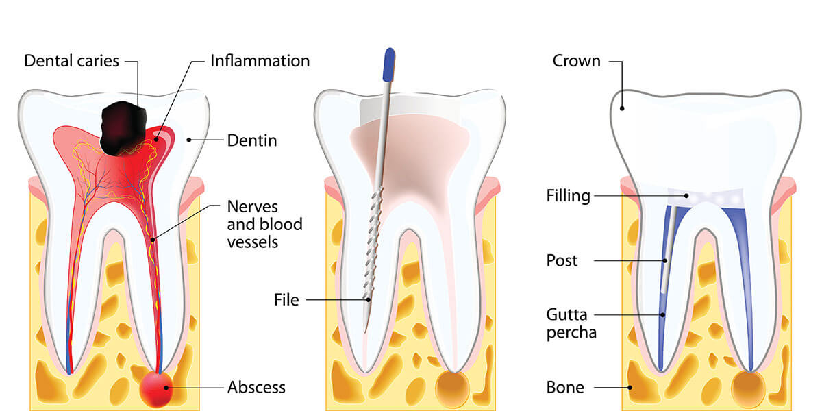 Bad Breath In The Throat: Remedies As Well As Causes