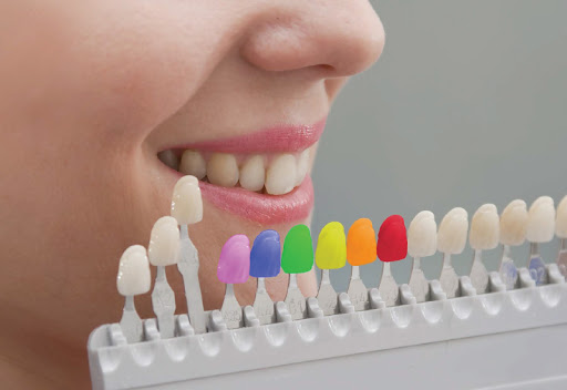 Facts About Tooth-Colored Fillings - Icard & Strein Family Dentistry