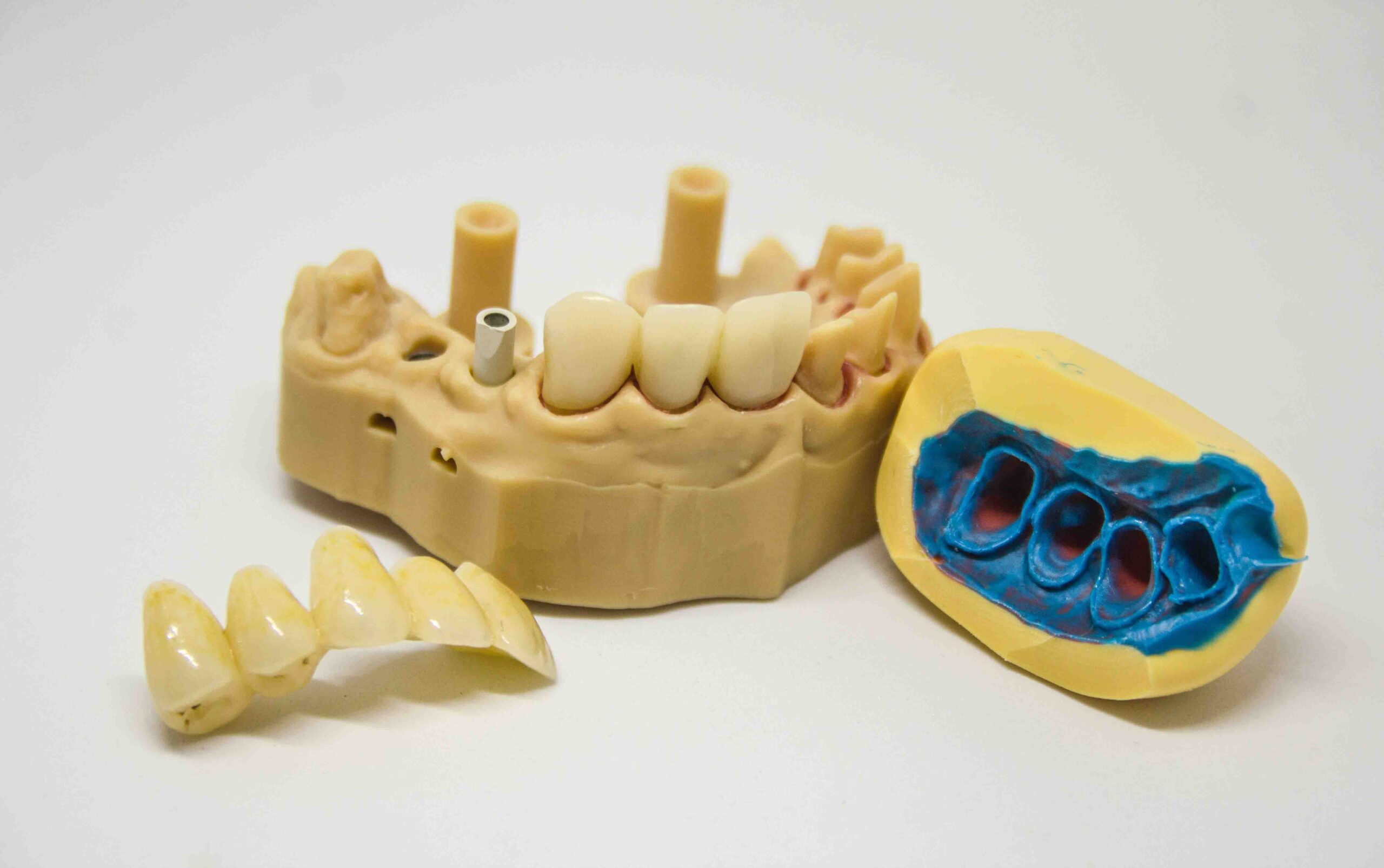 Treating Sleep Apnea With Dental Devices