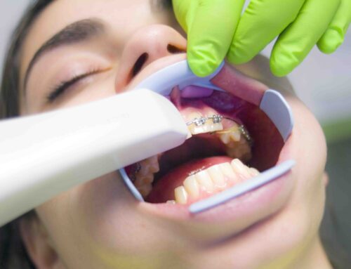 Types & Benefits Of Orthodontic Treatments