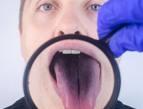 Why Is My Tongue Purple? (Causes Explained)