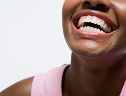 7 Professional Teeth Whitening Q&As