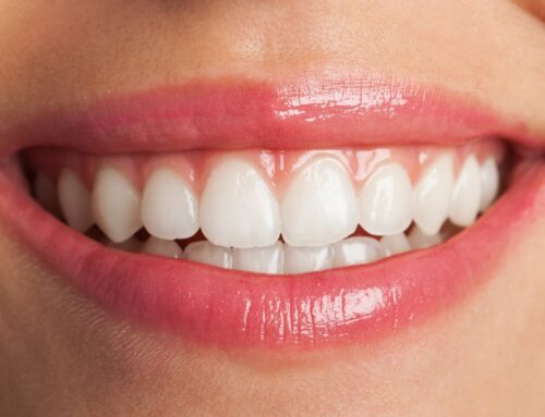 Why One Implant for Two Teeth May Not Be the Best Choice