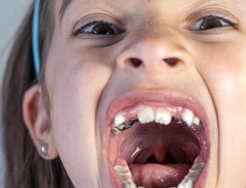 Hidden Causes of Tooth Decay in Kids’ Diets