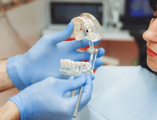 How to Clean and Store Oral Appliances