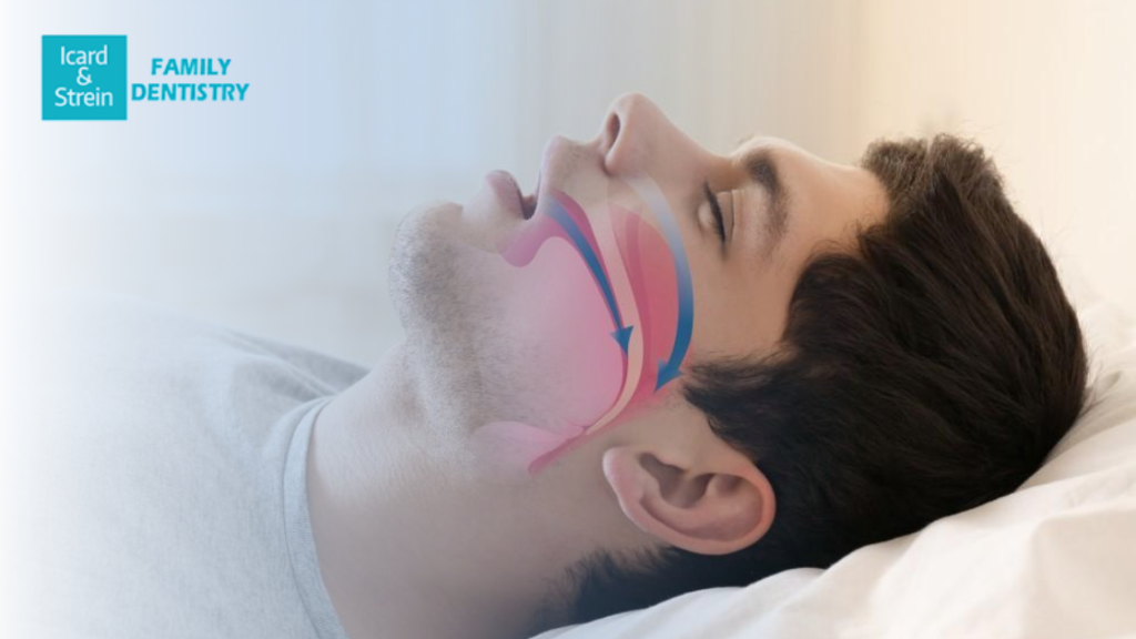 man lying down showing obstruction areas affected by sleep apnea
